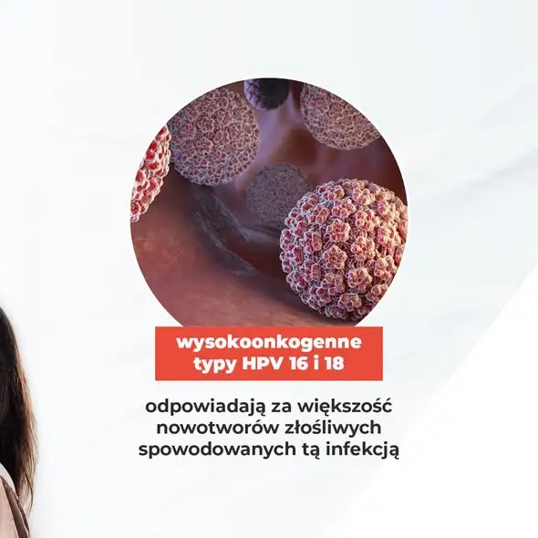 Nowotwory głowy i szyi: coraz więcej zachorowań wśród młodych. Kluczowa rola HPV